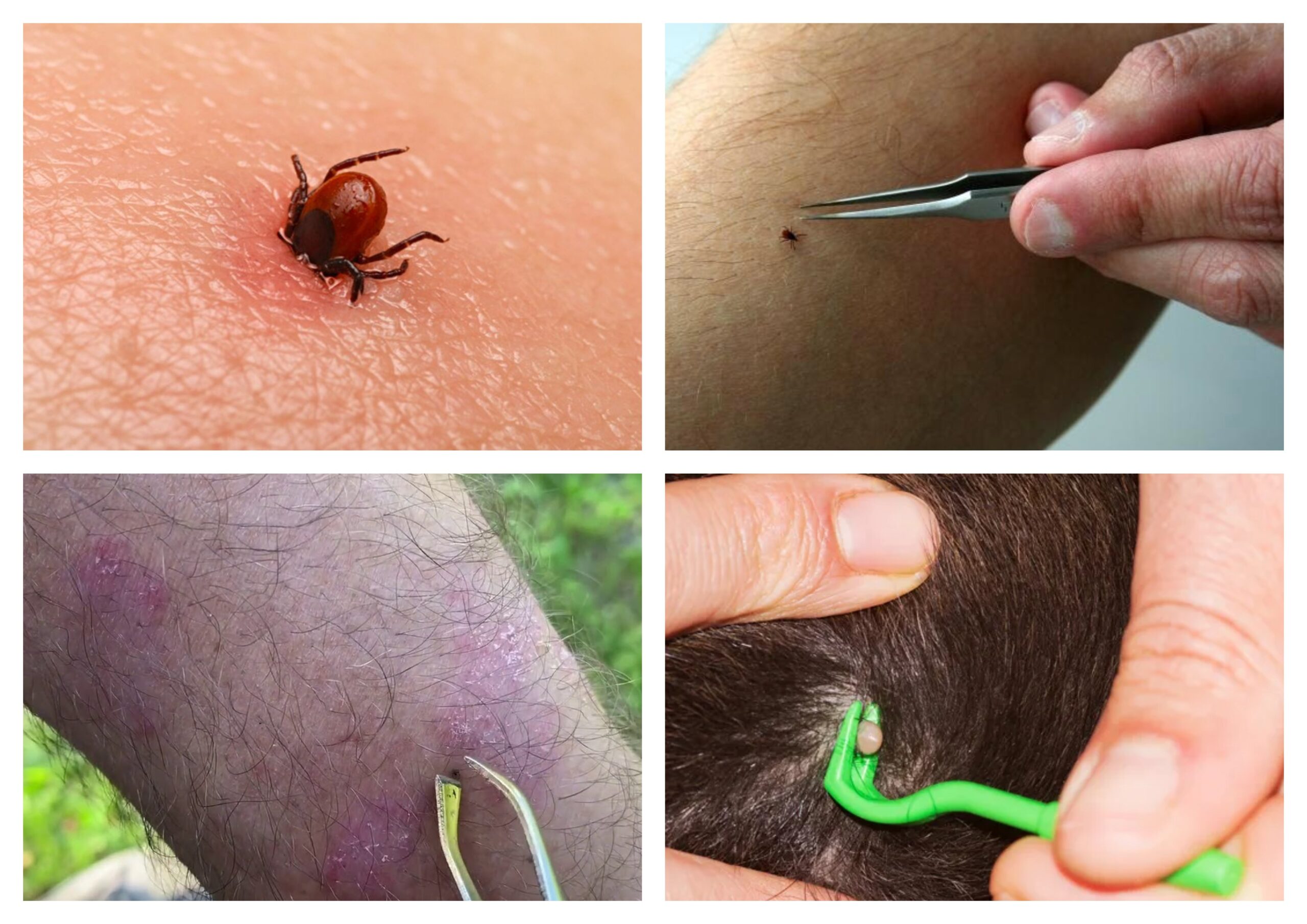 Kene Gibi Yapıştın Tenime